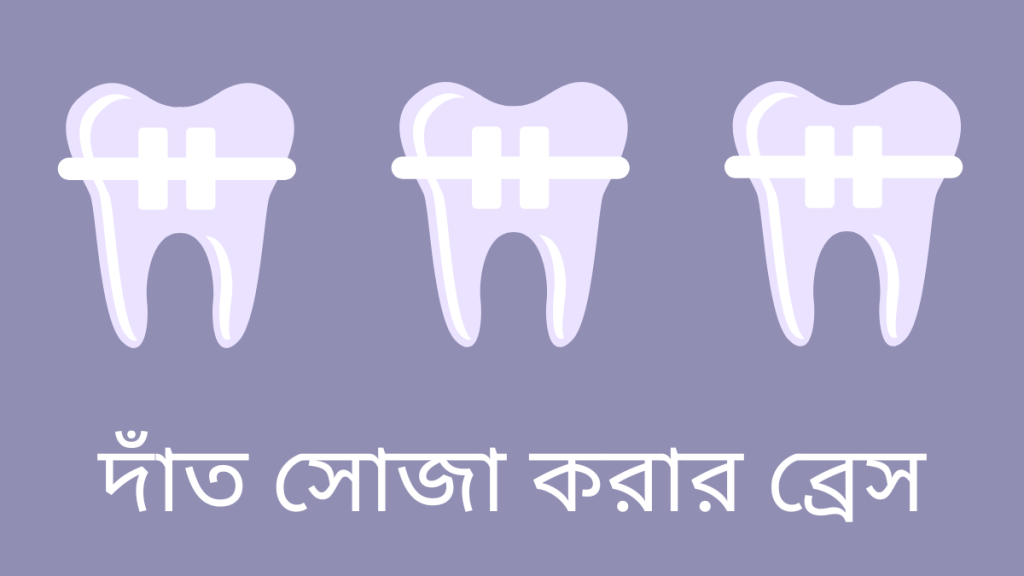 দাঁত সোজা করার ব্রেস